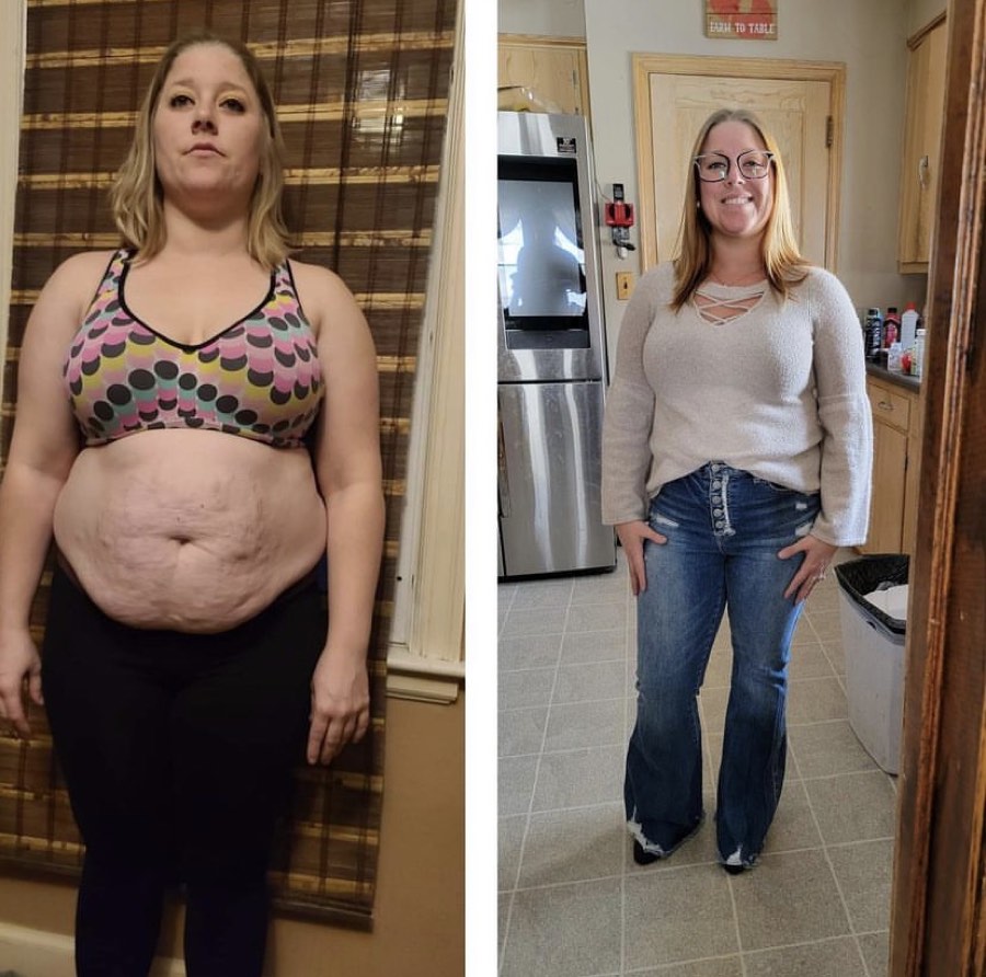 BURN member transformation