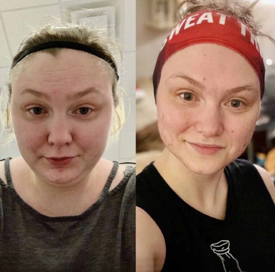 BURN member transformation