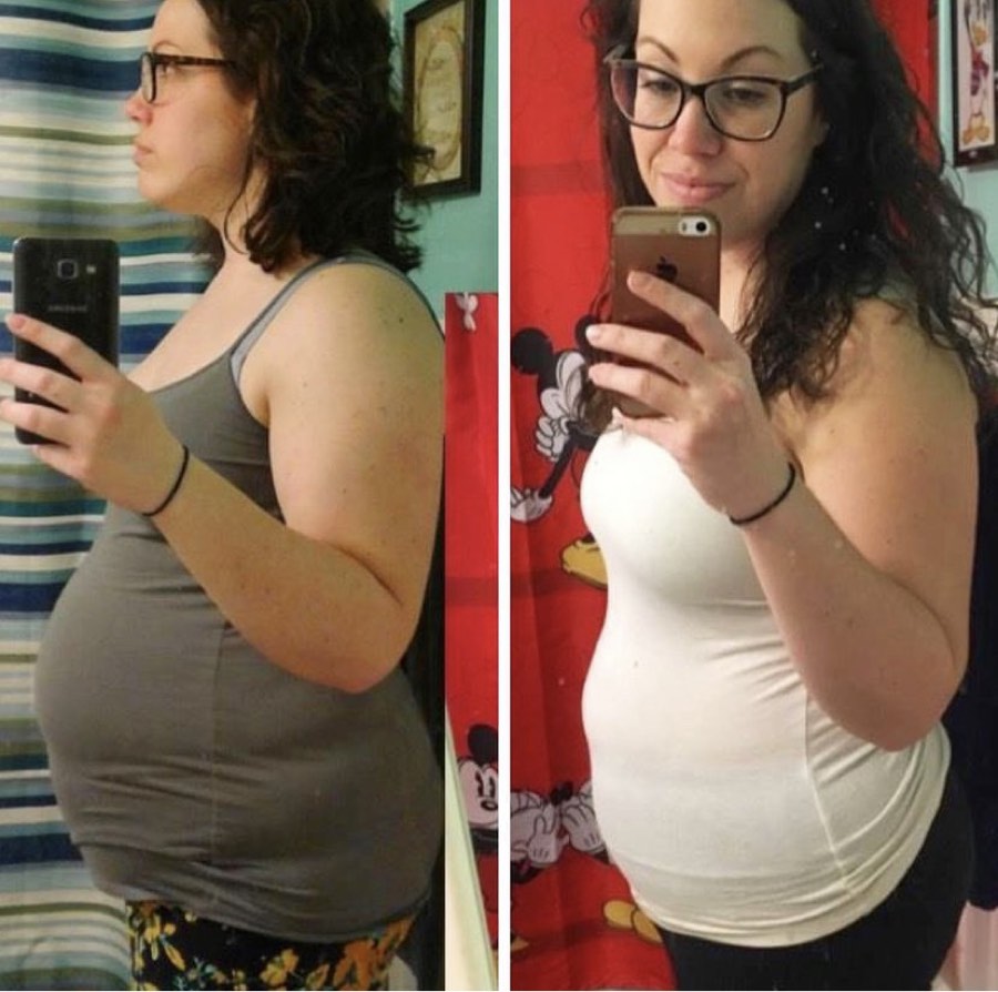 BURN member transformation